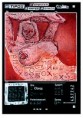 /album/hracie-pole/serigrafia-tipos-akty-xy-1-jpg/